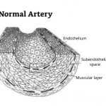מבנה-העורקים