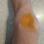 משחה-צהובה-על-רגלו-של-ספורטאי-כורכום-מים-ומעט-שמן-זית